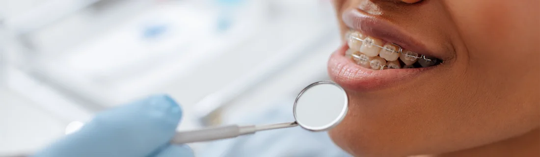 Orthodontics in Vista CA Orthodontics in Vista CA